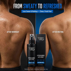 Hypochlorous Acid Spray – Post-Workout Skin Refresh Mist